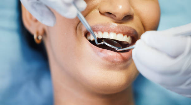 Best Emergency Cosmetic Dentistry (e.g., broken veneers) in Merriam Woods, MO
